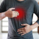 MAN with symptomatic acid reflux , suffering from acid reflux